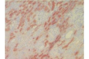 Immunohistochemical analysis of Human L-FABP in Frozen Human kidney tissue using FABP1 Antibody Cat. (FABP1 抗体)