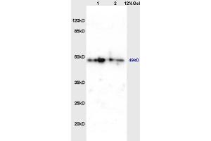Lane 1: mouse brain lysates Lane 2: mouse embryo lysates probed with Anti phospho-C-Myc(Thr358) Polyclonal Antibody, Unconjugated (ABIN752593) at 1:200 in 4 °C. (c-MYC 抗体  (pThr358))