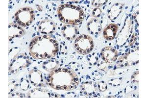 Immunohistochemical staining of paraffin-embedded Human liver tissue using anti-QPRT mouse monoclonal antibody. (QPRT 抗体)