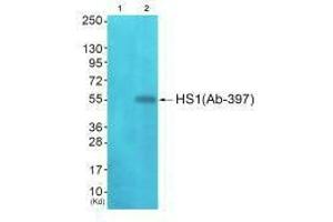 Western blot analysis of extracts from JK cells (Lane 2), using HS1 (Ab-397) antiobdy. (HCLS1 抗体  (C-Term))