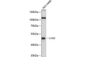 Western blot analysis of extracts of H460 cells, using LHX2 antibody (ABIN6128066, ABIN6143191, ABIN6143192 and ABIN6214989) at 1:1000 dilution. (LHX2 抗体  (AA 337-406))