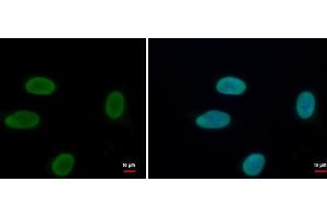 ICC/IF Image Histone H1. (Histone H1.3 抗体  (Center))
