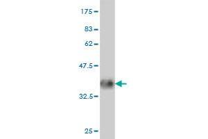 Western Blotting (WB) image for anti-Paraneoplastic Antigen MA1 (PNMA1) (AA 62-160) antibody (ABIN563990)