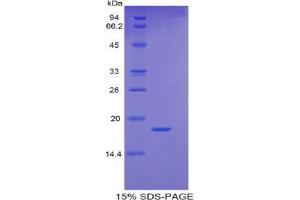 SDS-PAGE analysis of Human RBP5 Protein. (Retinol Binding Protein 5 蛋白)