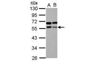 Image no. 2 for anti-Zinc Finger and BTB Domain Containing 9 (ZBTB9) (AA 1-206) antibody (ABIN1501798) (ZBTB9 抗体  (AA 1-206))