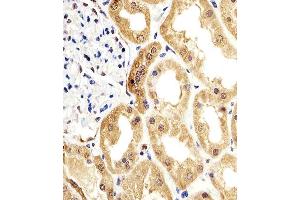 Paraformaldehyde-fixed, paraffin embedded human kidney tissue, Antigen retrieval by boiling in sodium citrate buffer (pH6. (ENO1 抗体)