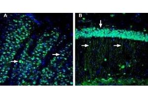 Expression of CD73 in mouse striatum and hippocampus. (CD73 抗体  (Extracellular, N-Term))