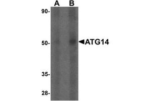 Western blot analysis of ATG14 in human small intestine tissue lysate with ATG14 Antibody  at (A) 1 and (B) 2 µg/mL. (ATG14 抗体  (Middle Region))