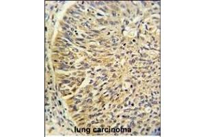 Immunohistochemistry (Paraffin-embedded Sections) (IHC (p)) image for anti-Chaperonin Containing TCP1, Subunit 3 (Gamma) (CCT3) (AA 298-326) antibody (ABIN389422)