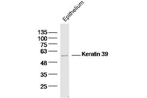 Mouse epithelium lysates probed with Keratin 39 Polyclonal Antibody, Unconjugated  at 1:300 dilution and 4˚C overnight incubation. (Keratin 39 (KRT39) (AA 401-491) 抗体)