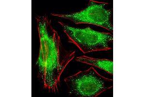 Fluorescent image of Hela cells stained with P2R2A Antibody (N-term) A.