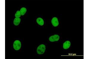 Immunofluorescence of purified MaxPab antibody to PMS2 on HeLa cell. (PMS2 抗体  (AA 1-862))