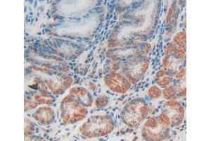 IHC-P analysis of Human Tissue, with DAB staining. (CCBL1 抗体  (AA 1-422))