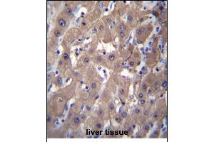 AKR1C2 Antibody (C-term) (ABIN656180 and ABIN2845509) immunohistochemistry analysis in formalin fixed and paraffin embedded human liver tissue followed by peroxidase conjugation of the secondary antibody and DAB staining. (AKR1C2 抗体  (C-Term))