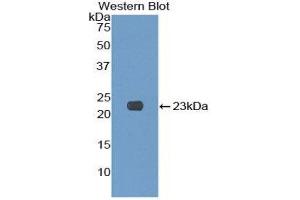 Western Blotting (WB) image for anti-Killer Cell Lectin-Like Receptor Subfamily C, Member 2 (KLRC2) (AA 19-190) antibody (ABIN1859564) (KLRC2 抗体  (AA 19-190))