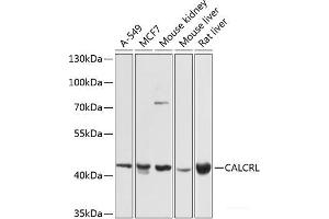 Western blot analysis of extracts of various cell lines using CALCRL Polyclonal Antibody at dilution of 1:1000. (CALCRL 抗体)