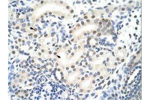 Image no. 1 for anti-Small Nuclear Ribonucleoprotein 70kDa (U1) (SNRNP70) (AA 21-70) antibody (ABIN203140) (SNRNP70 抗体  (AA 21-70))