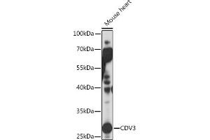 Western blot analysis of extracts of Mouse heart, using CDV3 Rabbit pAb (ABIN7266240) at 1:1000 dilution. (CDV3 抗体)