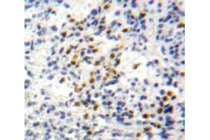 Used in DAB staining on fromalin fixed paraffin-embedded Spleen tissue (CXCL1 抗体  (AA 35-107))