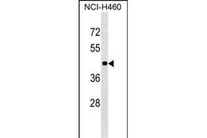 TOR3A Antibody (Center) (ABIN1537991 and ABIN2849201) western blot analysis in NCI- cell line lysates (35 μg/lane). (TOR3A 抗体  (AA 187-213))