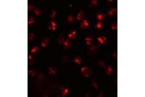 Immunofluorescence (IF) image for anti-ATPase, Ca++ Transporting, Type 2C, Member 2 (ATP2C2) (N-Term) antibody (ABIN1031251) (ATP2C2 抗体  (N-Term))