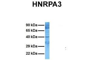 Host:  Rabbit  Target Name:  HNRPA3  Sample Tissue:  Human Jurkat  Antibody Dilution:  1. (HNRNPA3 抗体  (N-Term))