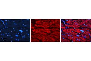Rabbit Anti-GNS Antibody   Formalin Fixed Paraffin Embedded Tissue: Human heart Tissue Observed Staining: Cytoplasmic Primary Antibody Concentration: 1:100 Other Working Concentrations: N/A Secondary Antibody: Donkey anti-Rabbit-Cy3 Secondary Antibody Concentration: 1:200 Magnification: 20X Exposure Time: 0. (GNS 抗体  (C-Term))