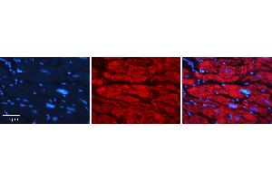 Rabbit Anti-GNS Antibody   Formalin Fixed Paraffin Embedded Tissue: Human heart Tissue Observed Staining: Cytoplasmic Primary Antibody Concentration: 1:100 Other Working Concentrations: N/A Secondary Antibody: Donkey anti-Rabbit-Cy3 Secondary Antibody Concentration: 1:200 Magnification: 20X Exposure Time: 0. (GNS 抗体  (C-Term))