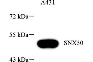 Western blot analysis of SNX30 (ABIN7075693),at dilution of 1: 1000 (SNX30 抗体)