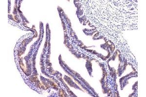 IHC analysis of RAB11B using anti-RAB11B antibody (ABIN6719364).