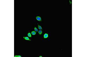Immunofluorescent analysis of HepG2 cells using ABIN7160637 at dilution of 1:100 and Alexa Fluor 488-congugated AffiniPure Goat Anti-Rabbit IgG(H+L) (SET Binding Factor 2 抗体  (AA 1585-1813))