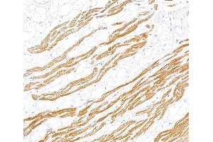 anti-Troponin I (TNNI) (AA 1-50) antibody