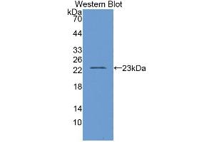 Western blot analysis of the recombinant protein. (D2HGDH 抗体  (AA 56-232))