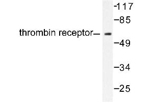 Image no. 1 for anti-Thyroid Hormone Receptor, alpha (THRA) antibody (ABIN271852) (THRA 抗体)