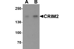 Western blot analysis of CRIM2 in Jurkat cell lysate with CRIM2 antibody at (A) 1 and (B) 2 µg/mL.