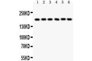 Western Blotting (WB) image for anti-Pregnancy-Associated Plasma Protein A, Pappalysin 1 (PAPPA) (AA 95-388) antibody (ABIN3043377) (PAPPA 抗体  (AA 95-388))
