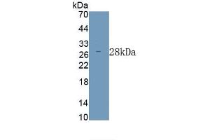 Detection of Recombinant ODC,Mouse using Polyclonal Antibody to Ornithine Decarboxylase (ODC) (ODC1 抗体)
