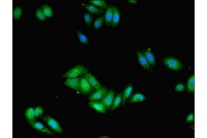 Immunofluorescent analysis of HepG2 cells using ABIN7155188 at dilution of 1:100 and Alexa Fluor 488-congugated AffiniPure Goat Anti-Rabbit IgG(H+L) (FCER1G 抗体  (AA 19-86))