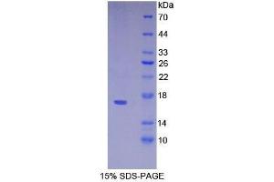 SDS-PAGE analysis of Mouse VPREB1 Protein. (VPREB1 蛋白)