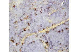 Anti-CXCL16 antibody, IHC(P): Mouse Spleen Tissue