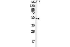 ZNF829 Antibody (Center) western blot analysis in MCF-7 cell line lysates (35 µg/lane). (ZNF829 抗体  (Middle Region))