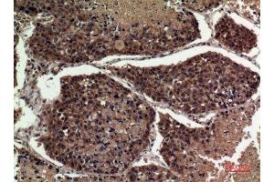 Immunohistochemistry (IHC) analysis of paraffin-embedded Human Lung, antibody was diluted at 1:100. (APOA1 抗体  (Internal Region))