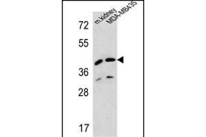 L2HGDH Antibody (Center) (ABIN654213 and ABIN2844053) western blot analysis in MDA-M cell line and mouse kidney tissue lysates (35 μg/lane). (L2HGDH 抗体  (AA 132-159))