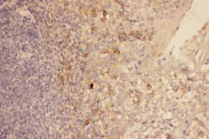 Anti-CXCR3 Picoband antibody,  IHC(P): Human Tonsil Tissue