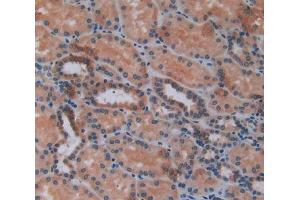 IHC-P analysis of kidney tissue, with DAB staining. (CXCL2 抗体  (AA 34-107))