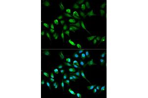 Immunofluorescence analysis of HepG2 cell using ADH5 antibody. (ADH5 抗体  (AA 1-374))