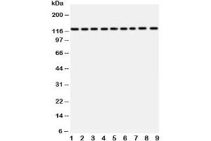 Western blot testing of TRPC3 antibody and Lane 1:  rat liver (TRPC3 抗体  (AA 836-851))