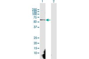 Western Blot analysis of CAMK2G expression in transfected 293T cell line by CAMK2G MaxPab polyclonal antibody. (CAMKII gamma 抗体  (AA 1-527))