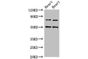 Western Blot Positive WB detected in: Rat heart tissue, Mouse heart tissue All lanes: Acss2 antibody at 4 μg/mL Secondary Goat polyclonal to rabbit IgG at 1/50000 dilution Predicted band size: 79 kDa Observed band size: 79, 50 kDa (ACSS2 抗体  (AA 1-701))