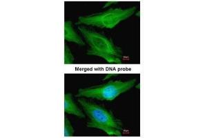 ICC/IF Image Immunofluorescence analysis of paraformaldehyde-fixed HeLa, using TUBB1, antibody at 1:200 dilution. (TUBB1 抗体)